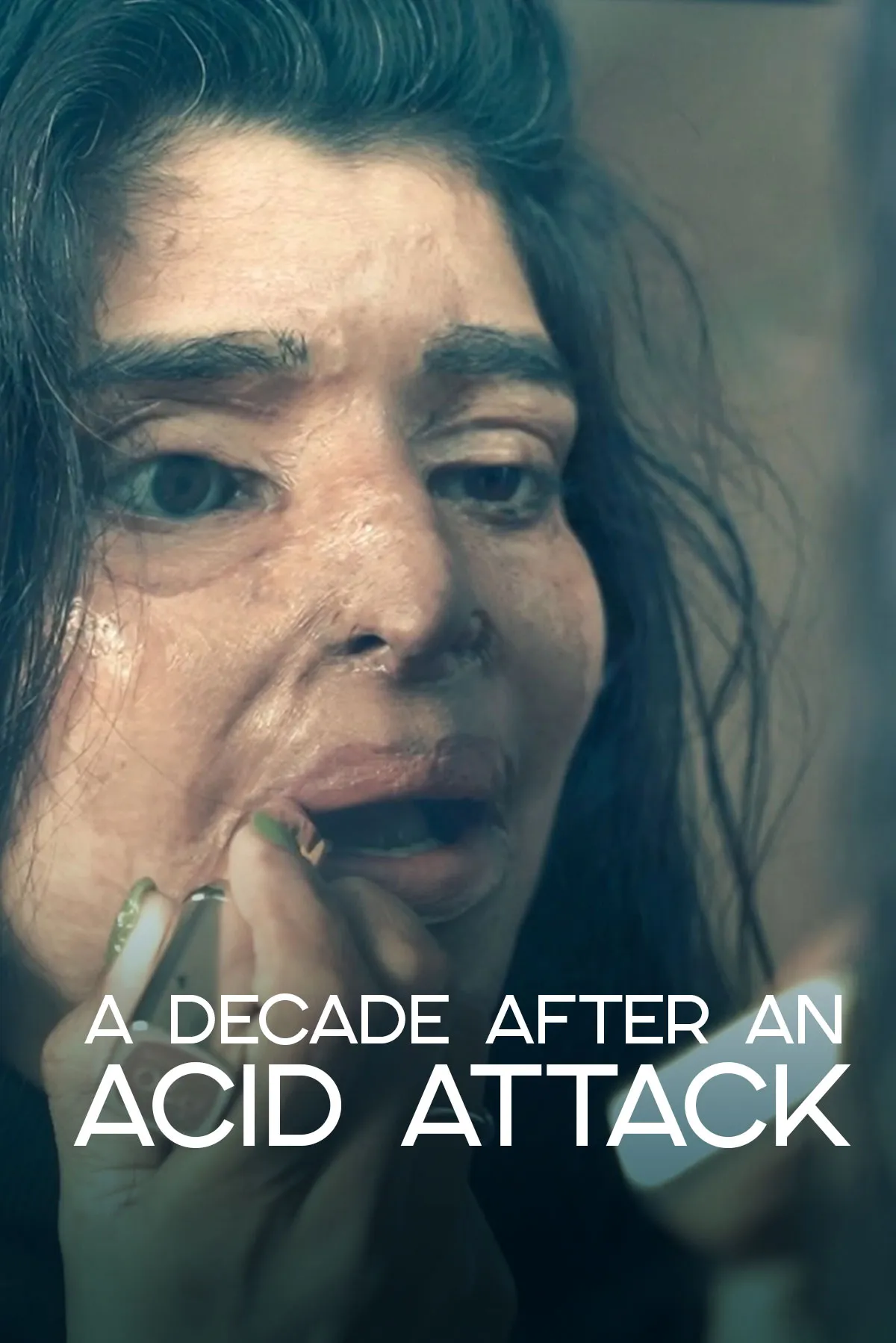 Documentary backdrop image for A Decade After An Acid Attack (2023)